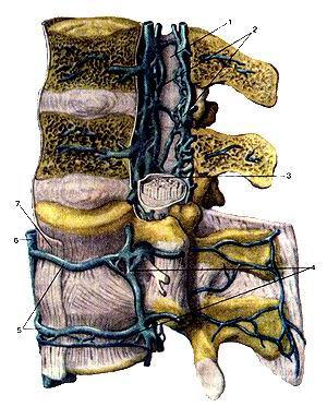 
  Рис. 314. Наружные и внутренние позвоночные сплетения (plexus venosus venebraiis 
  extemus et plexus venosus venebraiis interims). Вид слева. Позвоночный канал 
  частично вскрыт. I-позвоночный канал; 2-внутренние позвоночные венозные сплетения; 
  3-твердая оболочка спинною мозга; 4-наружное позвоночное венозное сплетение; 
  5-поясничные вены; 6-нижняя полая вена; 7-передния продольная связна (позвоночника).
  Fig. 314. Наружные и внутренние позвоночные сплетения.
  Вид слева. Позвоночный канал частично вскрыт. 1-canalis venebraiis; 2-plexus 
  venosus vertebralis internus; 3-araeh-noidea spinalis; 4-plexus venosus vertebralis 
  externus; 5-vv. lumbales; 6-v.cava interior; 7-lig. longitudinale anteriores.
  Fig. 314. txternal and iniernal vertebral plexuses. View from the left. fertebral 
  canal is partially opened.
  I-vertebral canal; 2-internaI vertebral venosous plexuses; 3-dura mater of spinal 
  coid; 4-extei nal vertebral venosous plexus; 5-lumbar veins; 6-inferior vena 
  cava; 7-anterior longitudinal ligament. 